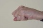 Full flexion following surgery: lateral view